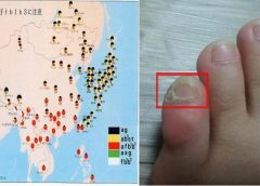 새끼발톱이 이렇게 생겼다면 100% 한국혈통이 아니라고?